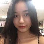 敏敏玻尿酸豐面頰術后190天 圖2