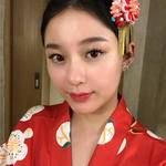 敏敏玻尿酸豐面頰術后121天 圖3
