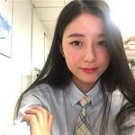 敏敏玻尿酸豐面頰術后83天 圖2