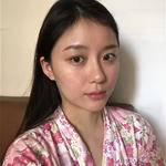 敏敏玻尿酸豐面頰術后91天 圖5