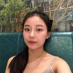 敏敏玻尿酸豐面頰術后75天 圖1