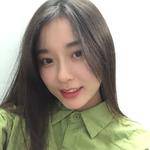 敏敏玻尿酸豐面頰術后60天 圖4