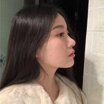 敏敏玻尿酸豐面頰術后138天 圖3