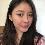 敏敏玻尿酸豐面頰術后91天 圖1