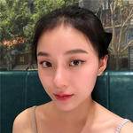 敏敏玻尿酸豐面頰術后75天 圖3