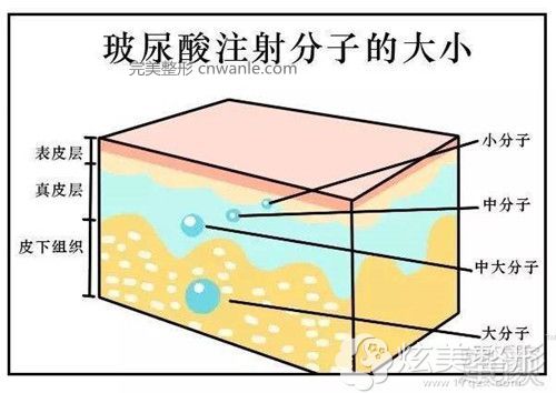 <a href='/tag_mianbusuxing.html'>面部塑形</a>采用中、<a href='/tag_dafenziboniao.html'>大分子玻尿酸</a>效果明顯