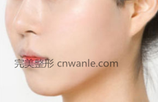 玻尿酸豐面頰會有效果嗎