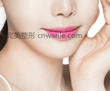玻尿酸豐面頰