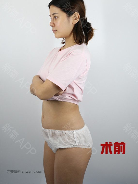 頭條