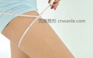 溫州藝星大腿吸脂