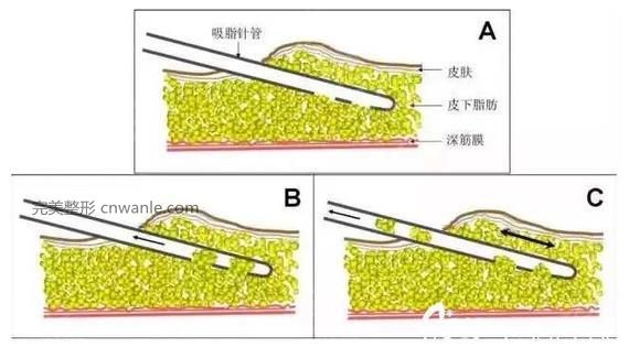 頭條