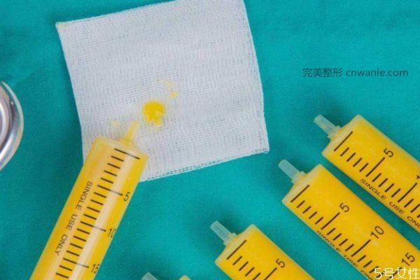 小腿<a href='/tag_xizhihuifandan.html'>吸脂會反彈嗎</a> 小腿吸脂能反彈嗎