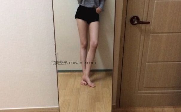 <a href='/tag_datuixizhishu.html'>大腿吸脂術(shù)</a>會(huì)反彈嗎？大腿吸脂術(shù)要注意什么？(1)