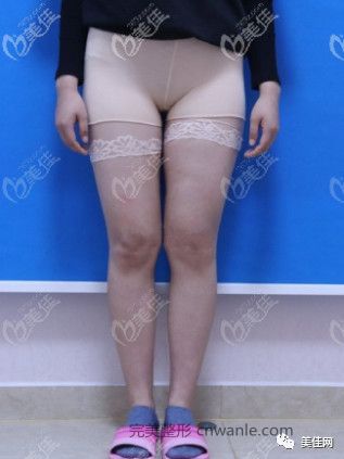 https://img.miyanlife.com/mnt/timg/200812/111342M16-0.jpg