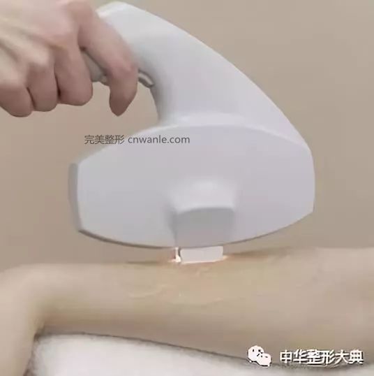 冰點(diǎn)脫毛的操作步驟及優(yōu)勢(shì) | 科普篇?
