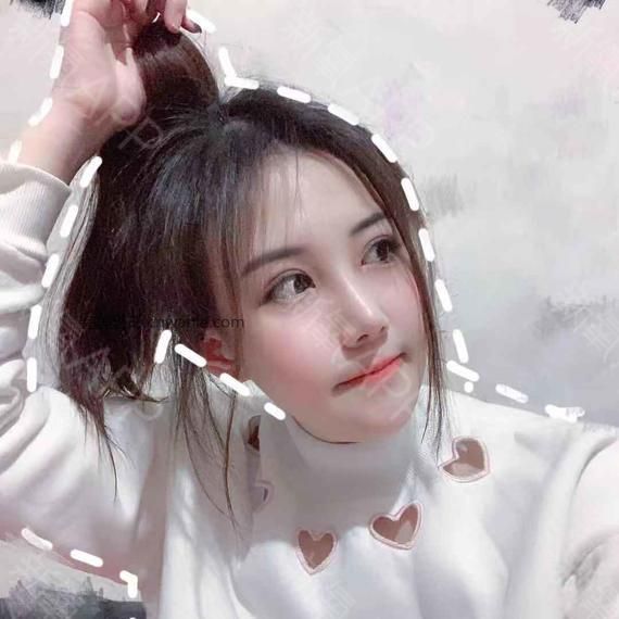 半永久紋發(fā)際線