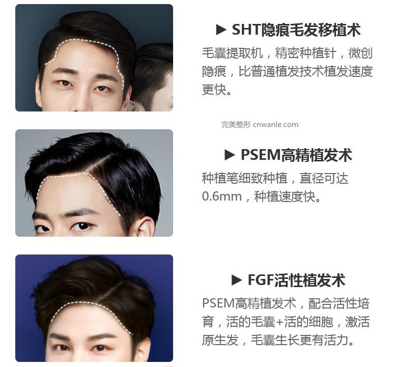 上海做半長久發(fā)際線做韓式的多少錢