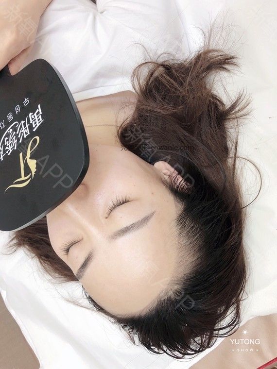 半永久紋發(fā)際線
