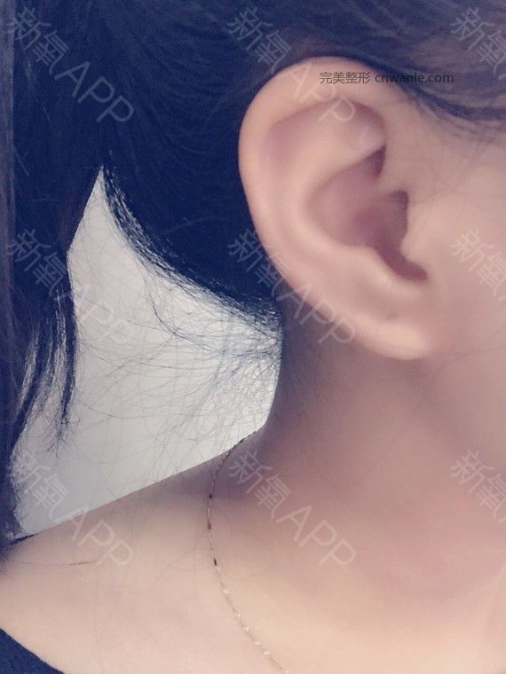 術(shù)后當(dāng)自強(qiáng)