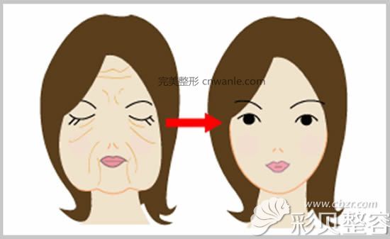 做電波拉皮除皺前后對(duì)比效果
