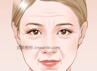 電波拉皮有什么樣的效果?