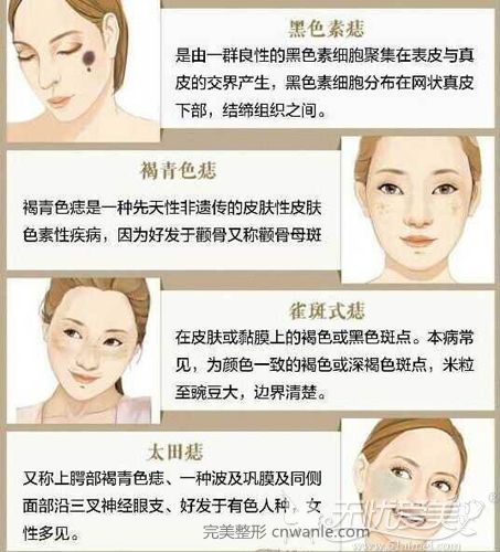 各種斑點的產(chǎn)生