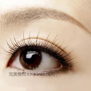 成都藝星開眼角手術(shù)效果怎么樣