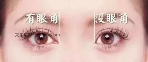 開(kāi)內(nèi)眼角除了讓眼睛變大還有哪些好處