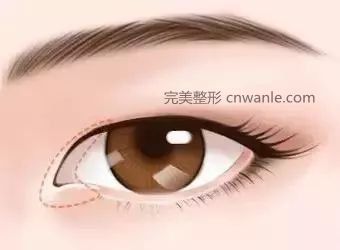 https://img.miyanlife.com/mnt/timg/180221/11300HR4-4.jpg