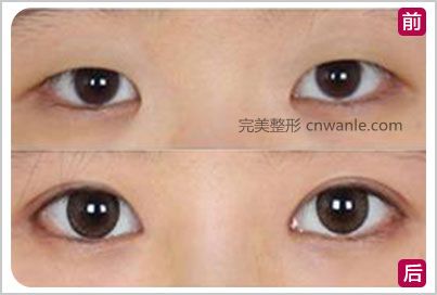 項目案例.jpg