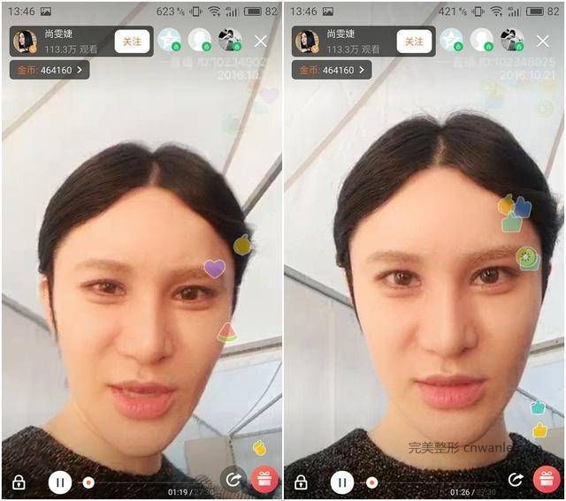 24歲超女整容殞命，江映蓉整成鬼，她整成男人，她穿裙子困難？
