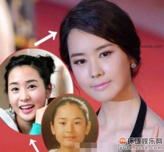 圖揭韓國明星整容部位 整容前后對比太驚悚