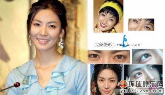 圖揭韓國明星整容部位 整容前后對比太驚悚