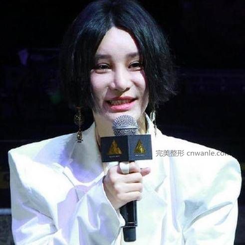 24歲超女整容殞命，江映蓉整成鬼，她整成男人，她穿裙子困難？