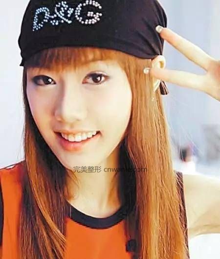 24歲超女整容殞命，江映蓉整成鬼，她整成男人，她穿裙子困難？