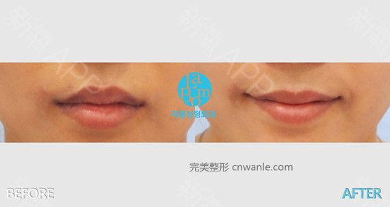 新氧