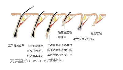 <a href='/tag_tuochunmao.html'>脫唇毛</a>