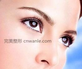 開眼角手術(shù)多久可以恢復(fù)？
