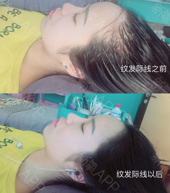 術(shù)后當(dāng)自強(qiáng)