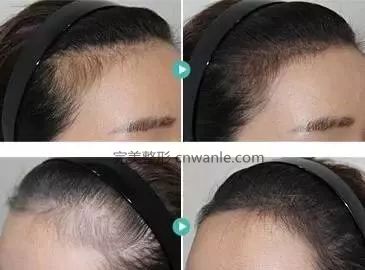https://img.miyanlife.com/mnt/timg/190416/11520524E-4.jpg