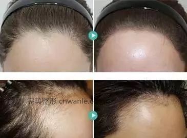 https://img.miyanlife.com/mnt/timg/190416/11520561U-3.jpg