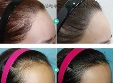 https://img.miyanlife.com/mnt/timg/190416/1152055002-2.jpg