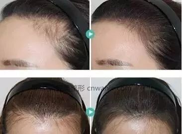 https://img.miyanlife.com/mnt/timg/190416/115204N01-1.jpg