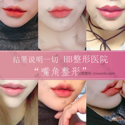 HB整形醫(yī)院官網(wǎng)案例