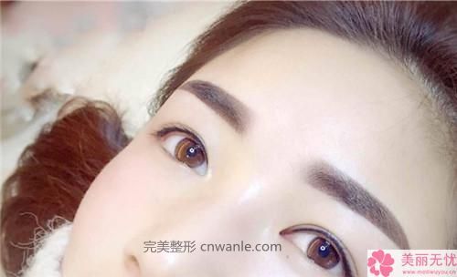 半永久紋發(fā)際線優(yōu)缺點及適合禁忌人群