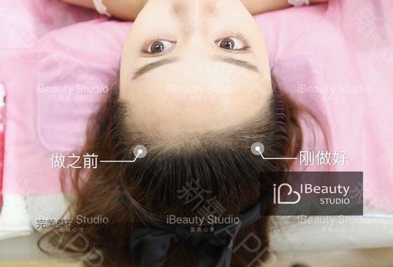 術后當自強