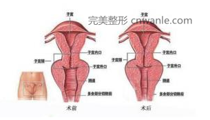 陰道緊縮術(shù)