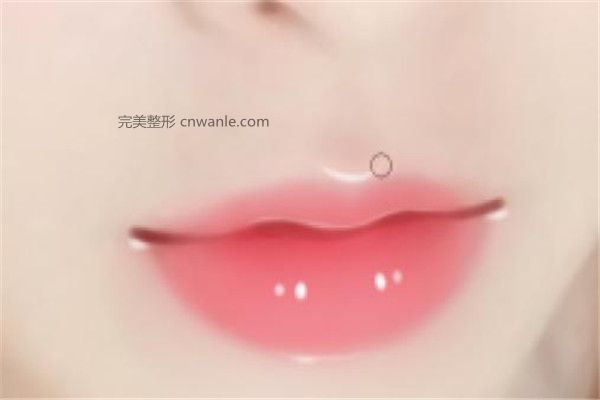 嘴角上揚(yáng)手術(shù)后悔了怎么辦 嘴角上揚(yáng)手術(shù)失敗