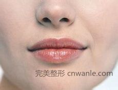 紋唇標(biāo)準(zhǔn)唇形