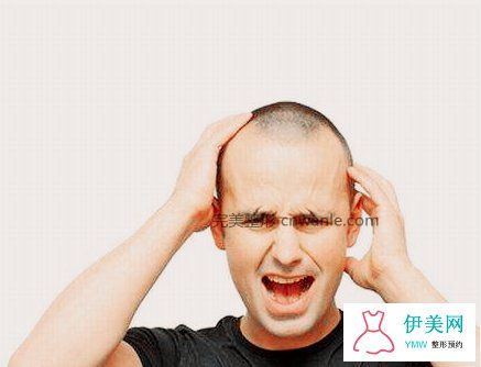 種植發(fā)際線和紋發(fā)際線有什么不同